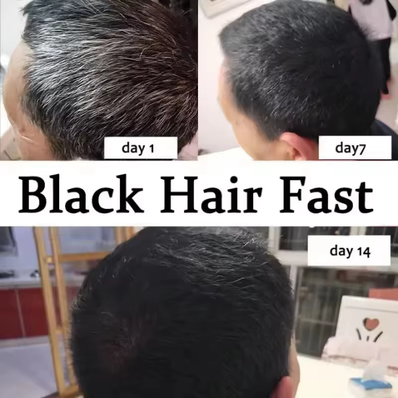 Siero Trattamento Capelli Grig - Hair Care Ginseng recensione e prezzo