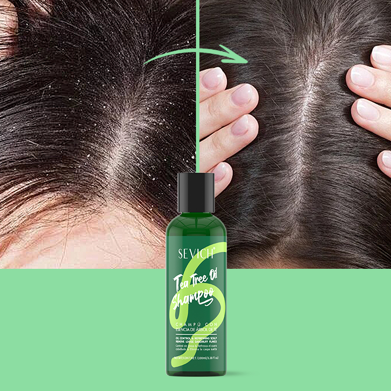 Tea Tree Essence Shampoo Balsa - Hair Care Conditioner recensione e prezzo