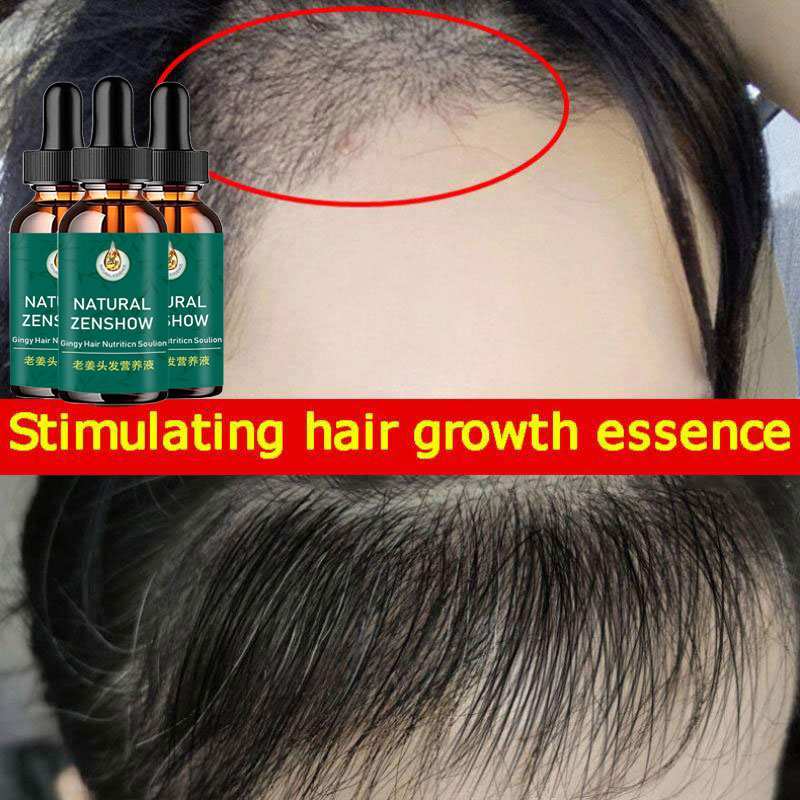 Zenzero crescita dei capelli o - Hair Care Herbal Products recensione e prezzo