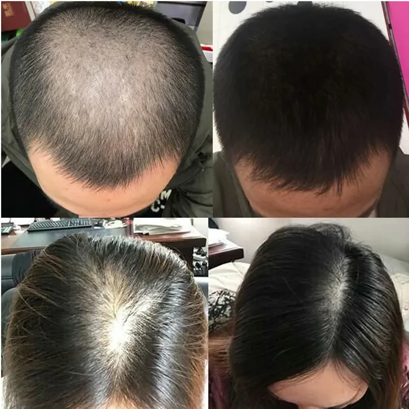 Liquido per la Crescita dei Ca - Hair Care Or Haircare recensione e prezzo