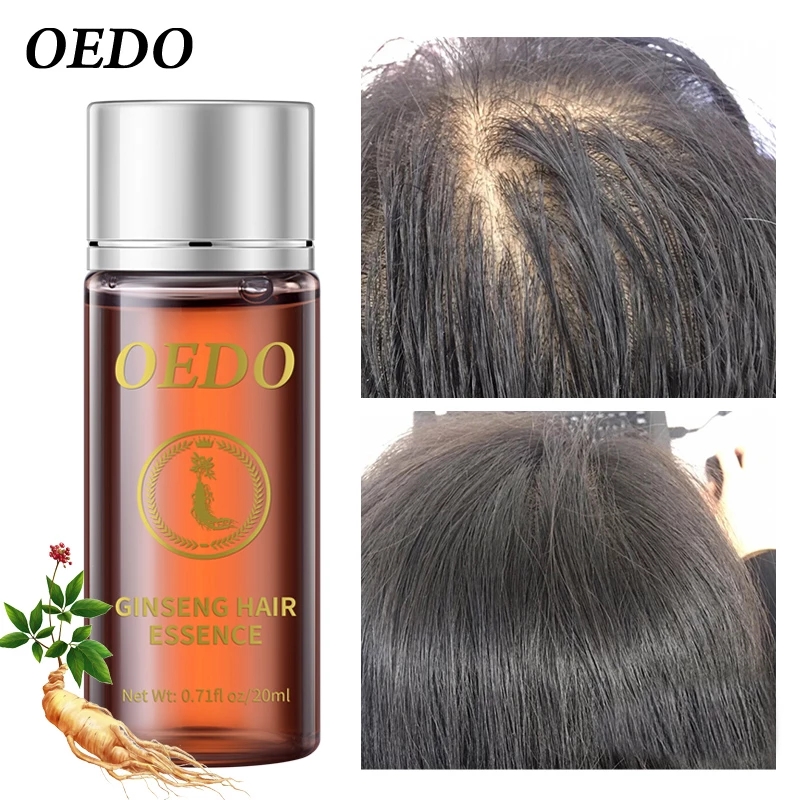 20ML Ginseng Essenza per la cr - Hair Care Ginseng recensione e prezzo
