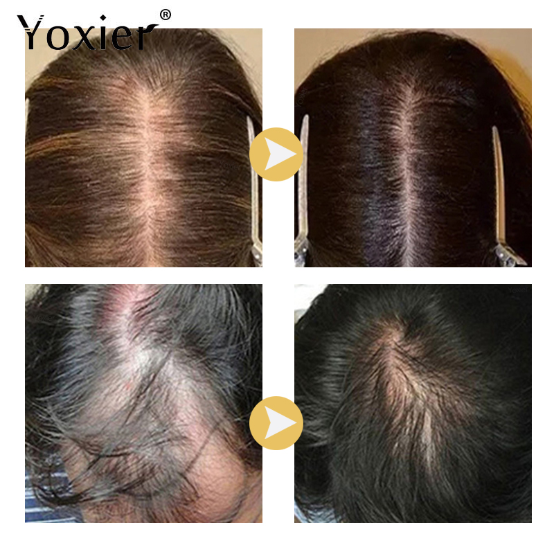 Siero per la crescita intensa  - Hair Care Ginseng recensione e prezzo
