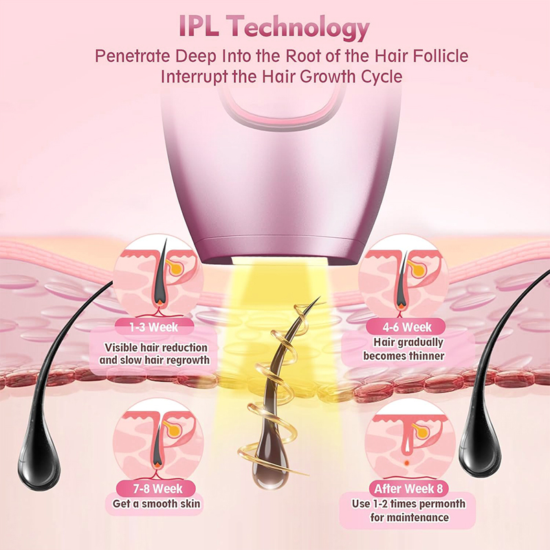 Epilatore laser IPL Macchina p - Hair Care Or Haircare recensione e prezzo