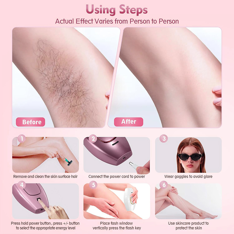 Epilatore laser IPL Macchina p - Hair Care Or Haircare recensione e prezzo