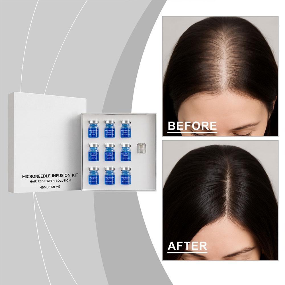 Set di Micro-Aghi con Siero Es - Hair Care Conditioner recensione e prezzo