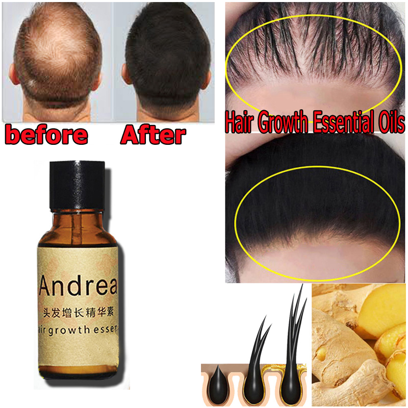 2/5/10 Pz Andrea Crescita Dei  - Hair Care Herbal Products recensione e prezzo